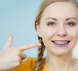  יישור שיניים למבוגרים: אף פעם לא מאוחר-תמונה